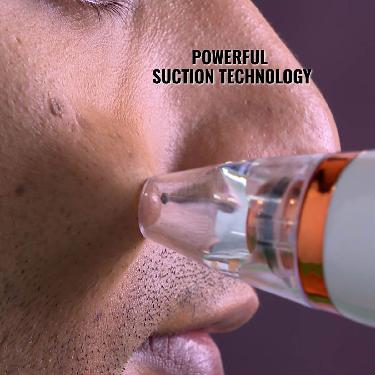 Instant Blackhead Remover Vacuum Suction Device For Men (BHR2)
