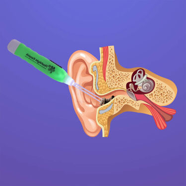 Earwax Cleaner With Flashlight Buy 1 Get 1 Free (EDC2)
