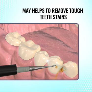 Ultrasonic Teeth Stain Remover (ETSE)