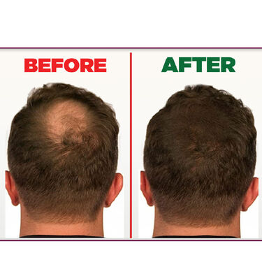 Quick And Easy Hair Gap Solution