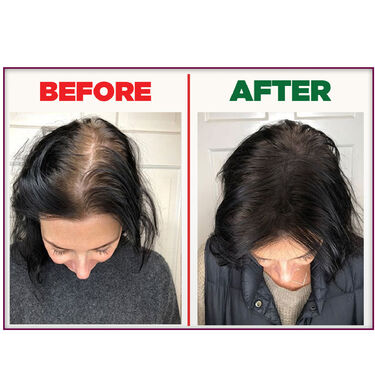 Quick And Easy Hair Gap Solution