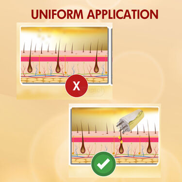 Scalp Oil Applier (OA)