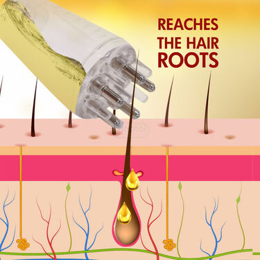 Scalp Oil Applier (OA)